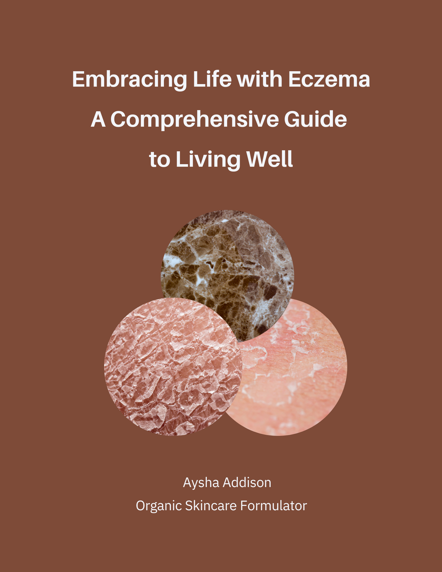 Embracing Life with Eczema: A comprehensive Guide to Living Well - Ebook